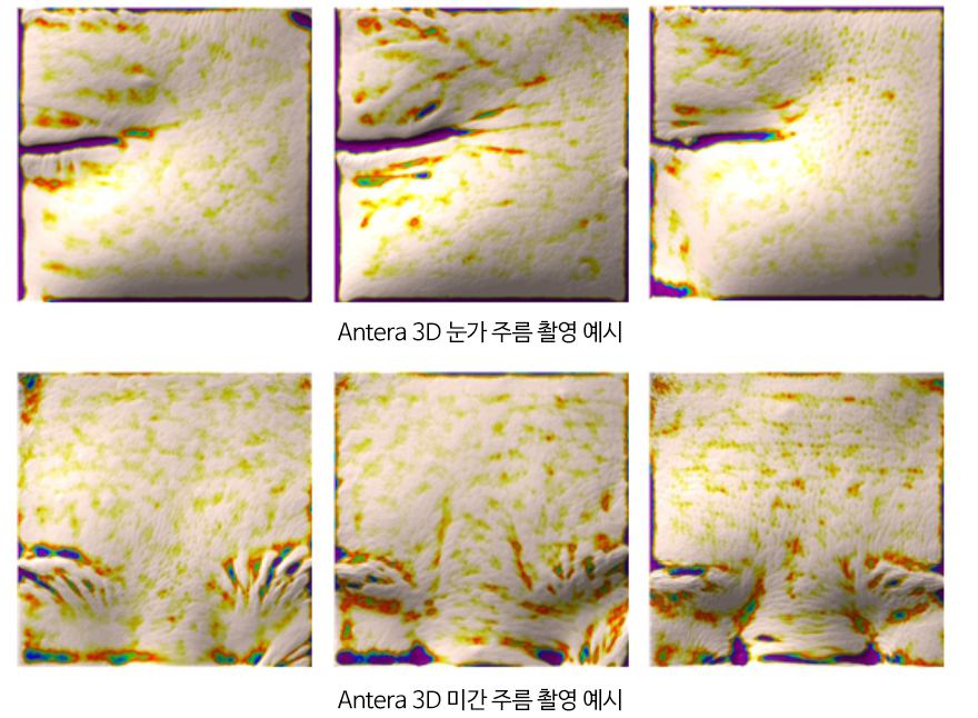 Antera 3D 눈가 주름 촬영 예시 / Antera 3D 미간 주름 촬영 예시 이미지