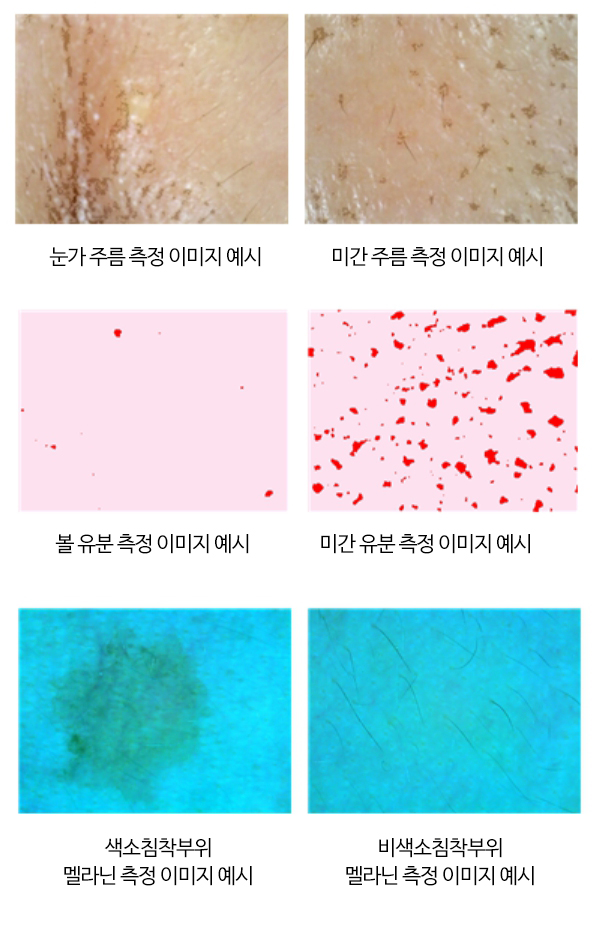 눈가 주름 측정 이미지 예시 / 이간 주름 측정 이미지 예시 / 볼 유분 측정 이미지 예시 / 미간 주름 측정 이미지 예시 / 색소침착부위 멜라닌 측정 이미지 예시 / 비색소침착부위 멜라닌 측정 이미지 예시
